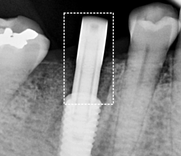29ef42d7090a68cfb8aca42e15b3089c_1754369715_51.jpg
