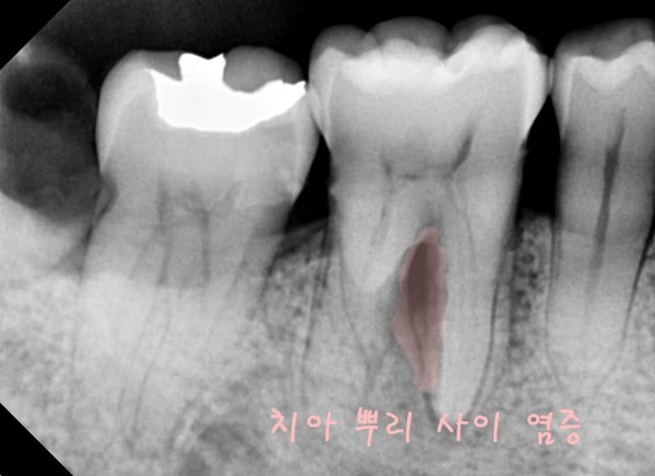 29ef42d7090a68cfb8aca42e15b3089c_1754375594_03.jpg