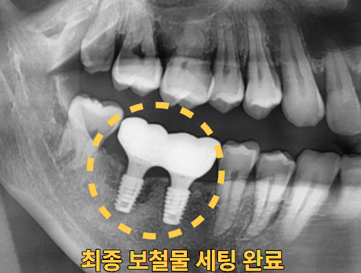 76e1ed916c48918ae0cf0dff3e2db9cf_1778827035_89.png 76e1ed916c48918ae0cf0dff3e2db9cf_1778827035_89.png