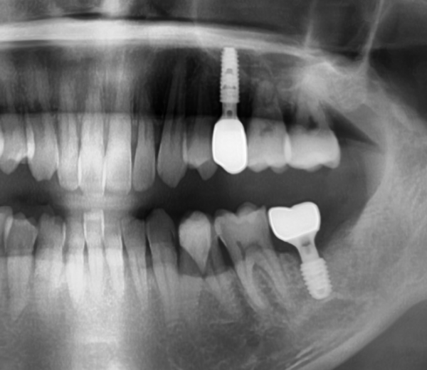 76e1ed916c48918ae0cf0dff3e2db9cf_1778826932_63.png
