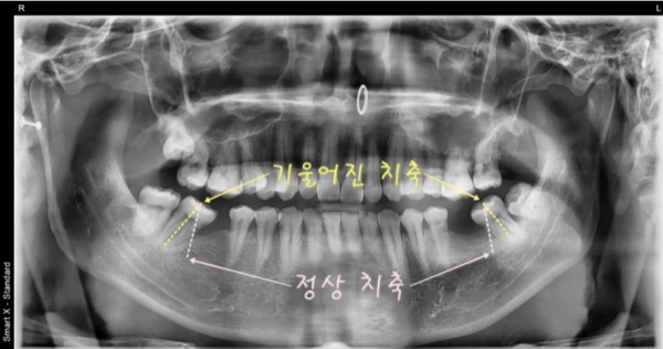 d34e1acf6ef18fefa2533f844c7b5cee_1782711113_02.png