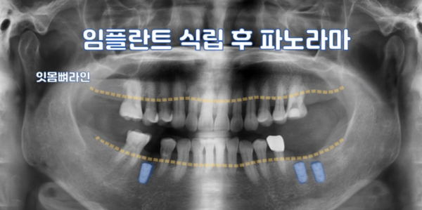 fdd56eab0bfb985421cd1814d61112dd_1784873545_92.png