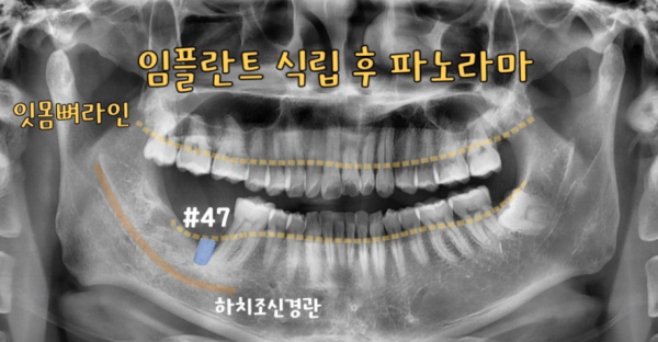 fdd56eab0bfb985421cd1814d61112dd_1784874722_21.png