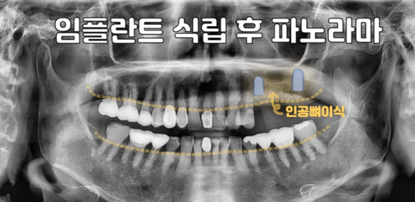 fdd56eab0bfb985421cd1814d61112dd_1784875266_15.png