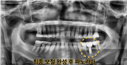 4c55b527717277875490d08bdb8bc614_1790654991_4.png 4c55b527717277875490d08bdb8bc614_1790654991_4.png