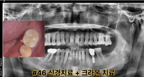 1ce20c85ac55b0f75ad90952a62ce89a_1792113379_13.png 1ce20c85ac55b0f75ad90952a62ce89a_1792113379_13.png